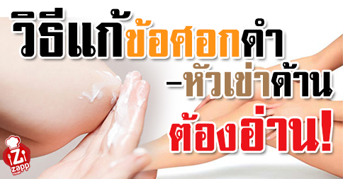 Zappnuar Story : วิธีแก้ข้อศอกดำ-หัวเข่าด้าน ต้องอ่าน!